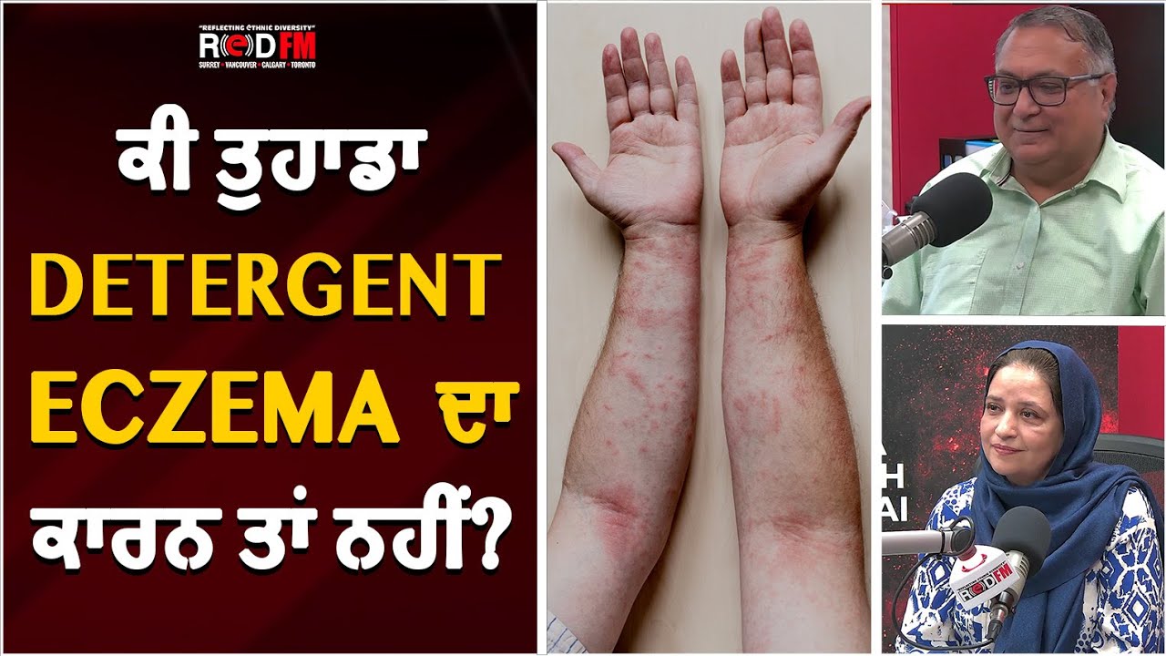 ਕੀ ਤੁਹਾਡਾ Detergent Eczema ਦਾਕਾਰਨ ਤਾਂ ਨਹੀਂ ? Can Detergent Cause Eczema? RED FM Canada YouTube