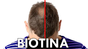 ¿Me engrosará el pelo la biotina?