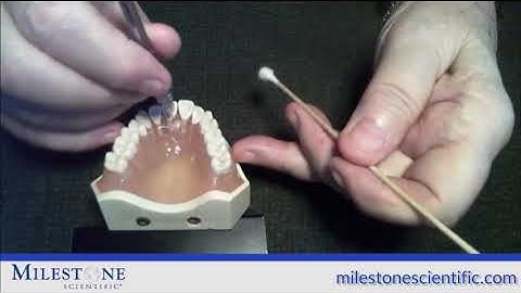 MLSS - Full Library of Injection Videos with the STA System (Wand STA)