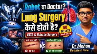 Robot या Doctor? Lung Surgery कैसे होती है? | VATS & Robotic Lung Surgery Explained