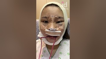 Plastic surgery transformation in Korea #idhospital #shorts