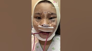 Thumbnail of Plastic surgery transformation in Korea #idhospital #shorts