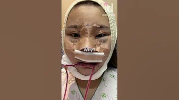 Plastic Surgery Transformation In Korea Idhospital Shorts 