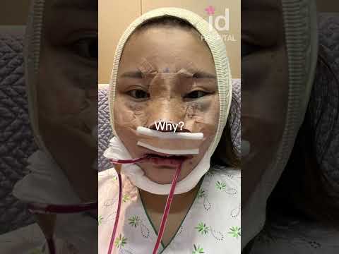 Plastic Surgery Transformation In Korea Idhospital Shorts