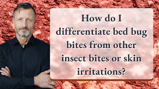How do I differentiate bed bug bites from other insect bites or skin irritations?