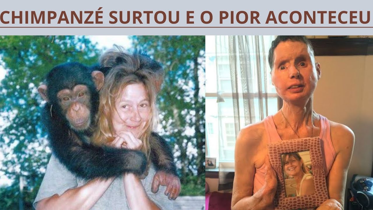 Chimpanzé Surta e Ataca Mulher Brutalmente a Deixando gravemente ferida Ataque Animal YouTube Chimpanzé Surta e Ataca Mulher Brutalmente a Deixando gravemente ferida Ataque Animal YouTube