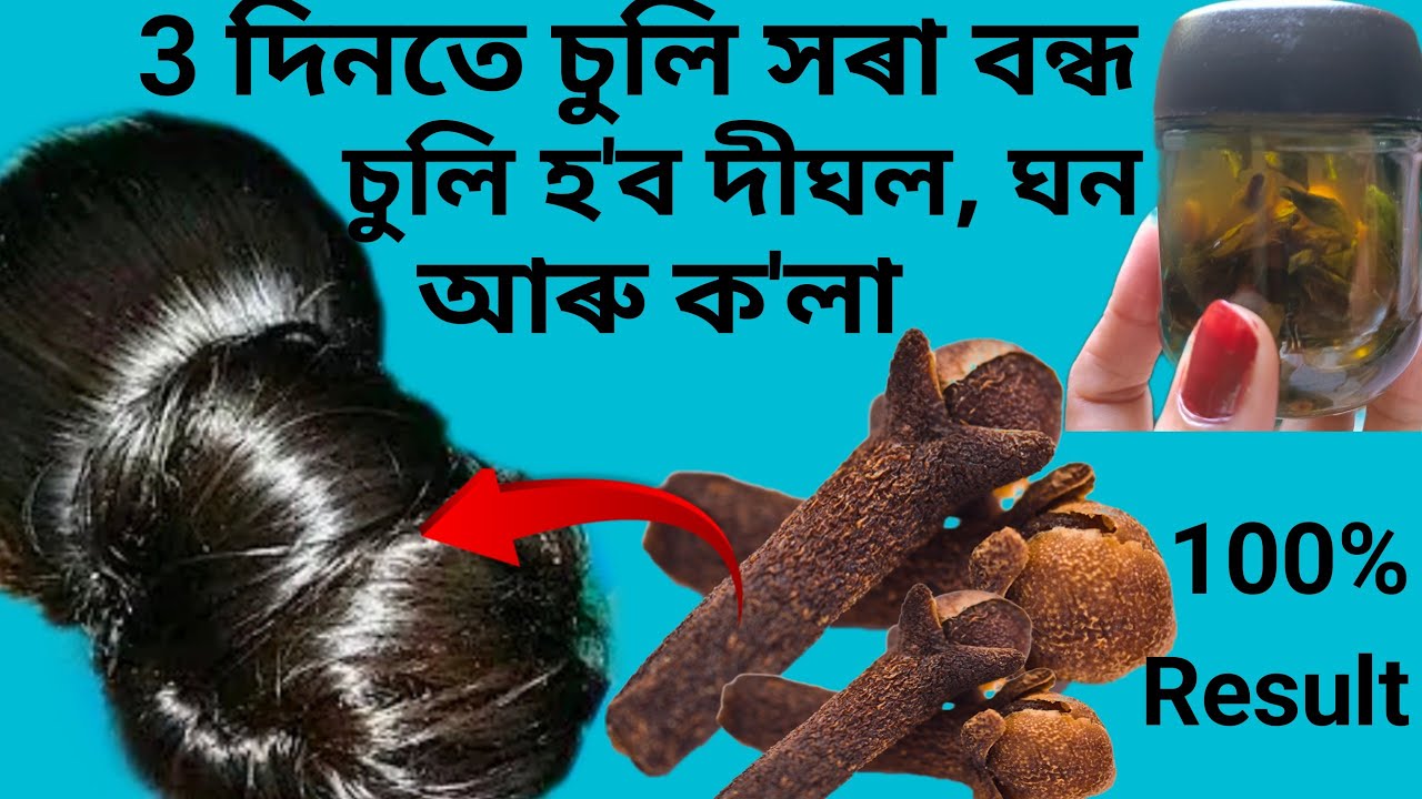 3 দিনতেই চুলি সৰা, চুলি পকা বন্ধ হ'ব, চুলি দীঘল,ঘন আৰু ক'লা হ'ব  | vlog