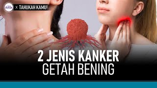 Perbedaan Kanker Getah Bening (Limfoma) Hodgkin dan Non-Hodgkin | Hidup Sehat tvOne Perbedaan Kanker Getah Bening (Limfoma) Hodgkin dan Non-Hodgkin | Hidup Sehat tvOne