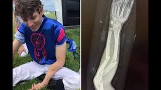 Bboy/Break dance Fails 2021