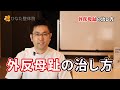 外反母趾の治し方【５つの方法】