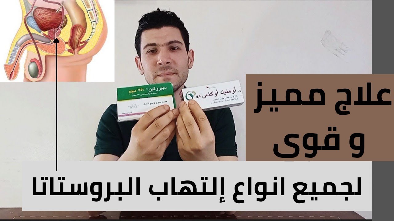 أفضل و أسرع علاج لإلتهاب البروستاتا نهائيا بكافه انواعها و كيفيه الوقايه منها