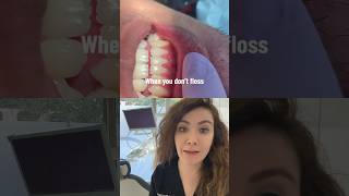 What Will Happen If You Don’t Floss And Brush Regularly?!