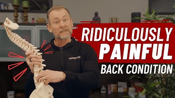 Lumbar Radiculopathy = Ridiculously Painful! | Health Matters