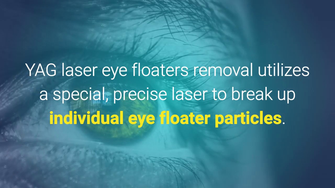 Eye Floaters Removal - Cure Eye Floaters At Home - Eye Floaters No More Secrets Revealed