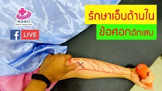 รักษาเอ็นด้านในข้อศอกอักเสบ ปวดด้านในข้อศอก รักษาเอ็นด้านในข้อศอกอักเสบ ปวดด้านในข้อศอก