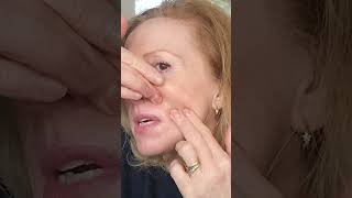 Erase Smile Lines Instantly with This Deep Massage Technique! 😲✨ #SkincareHack #facemassage #face