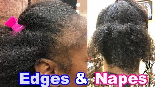 How to Finally Grow Your Edges, Nape and Crown! FREE Class
