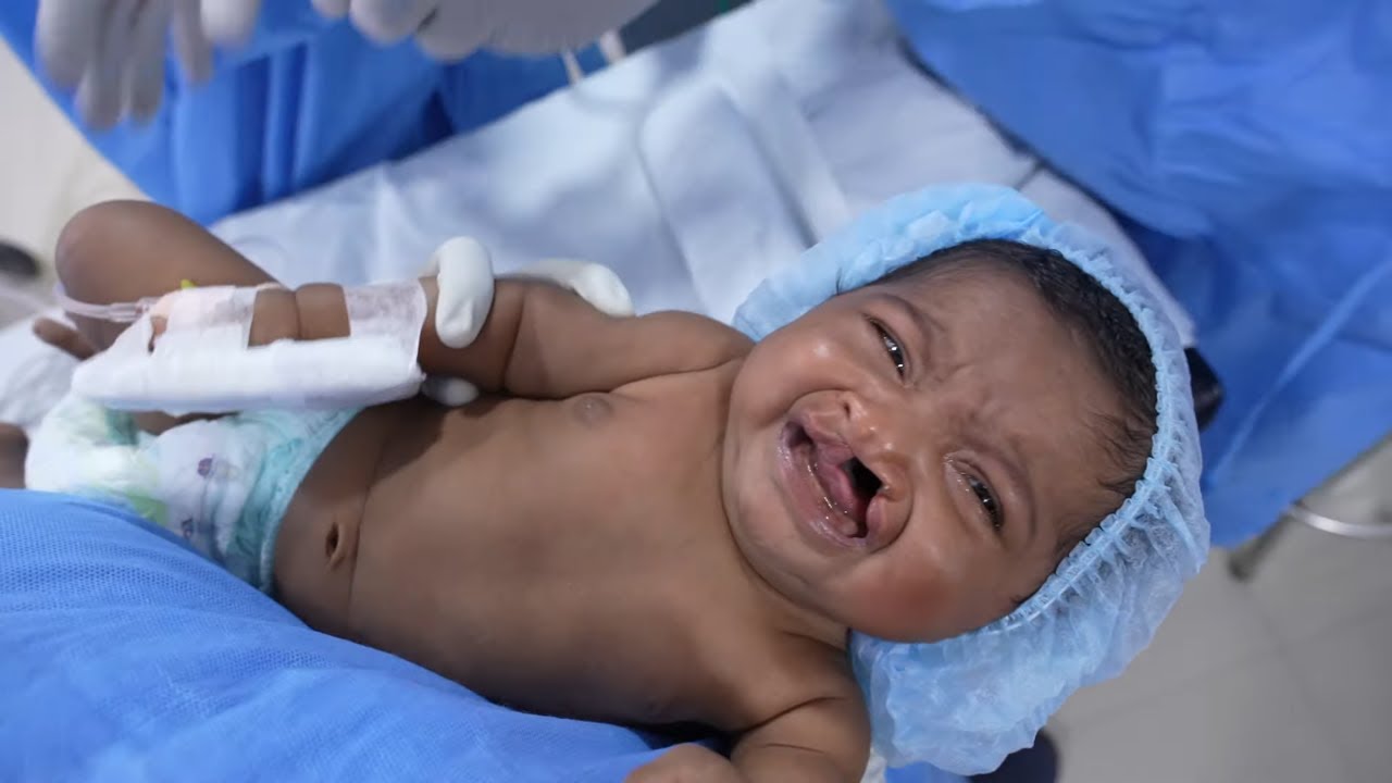 Baby Anesthesia A Painful but Necessary Process YouTube