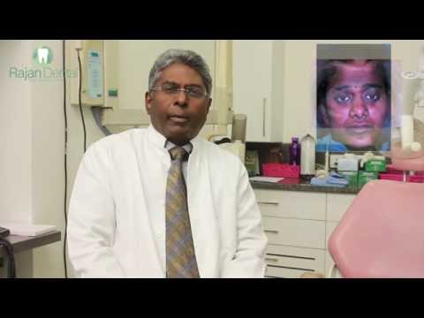a-worldwide-first:-successful-zygoma-implant-on-a-17-year-old-patient-with-pappilon-lefevre-syndrome