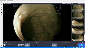 Como Capturar imagens e criar laudos no Zscan EVO