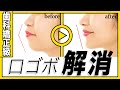 【歯科矯正級】口ゴボを解消して綺麗なEラインを手に入れる方法!
