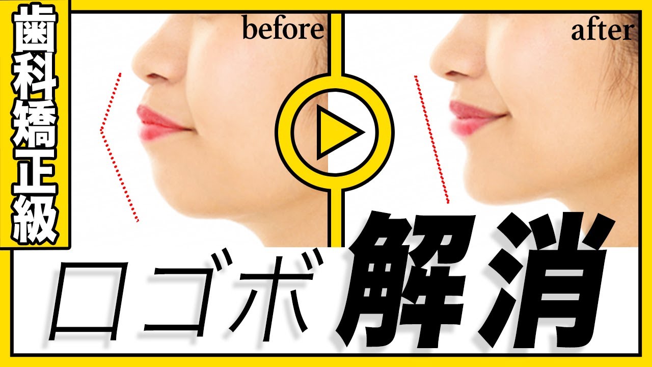 【歯科矯正級】口ゴボを解消して綺麗なEラインを手に入れる方法！ のサムネイル