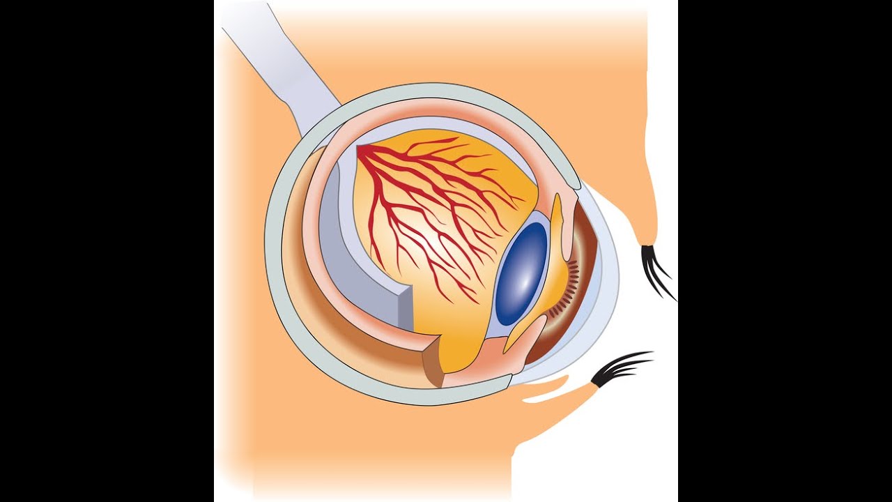 Симптомы и признаки глаукомы глаза - YouTube