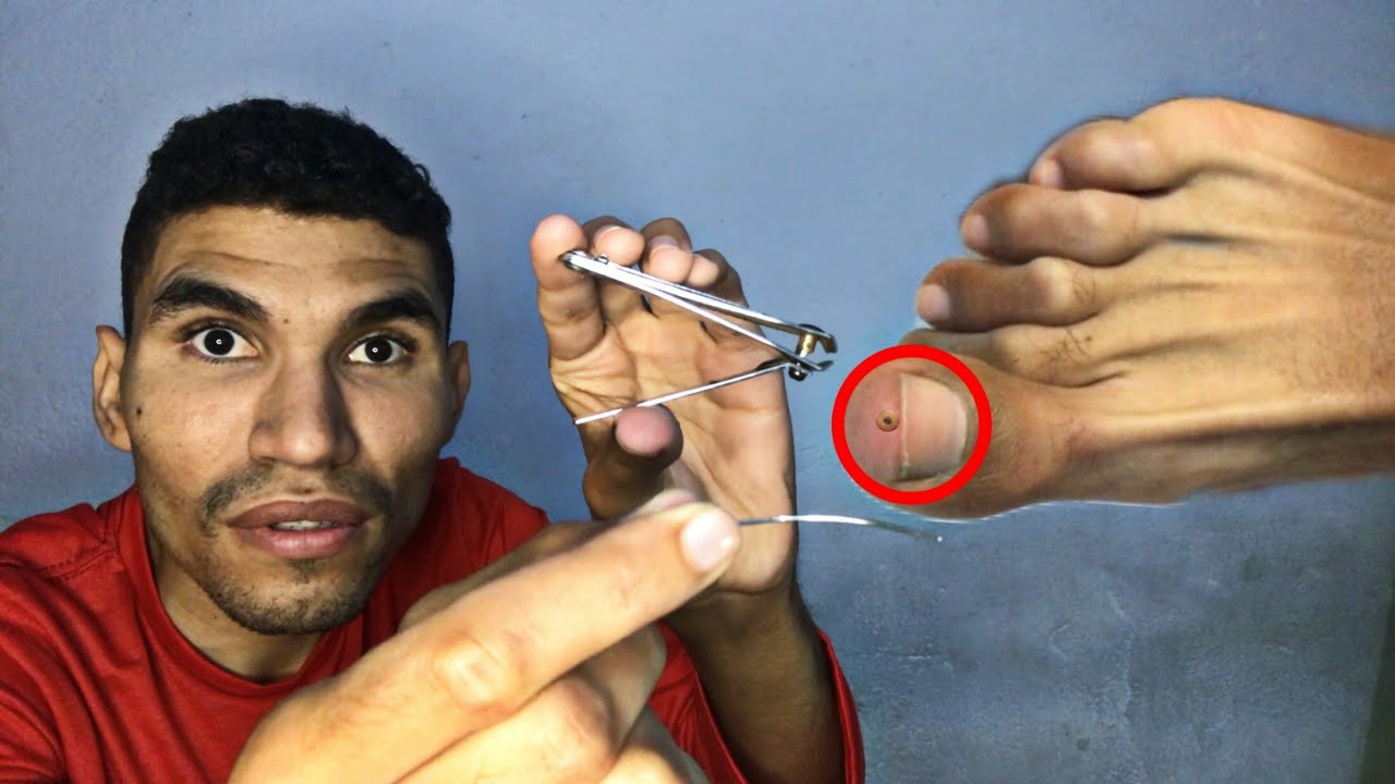 ASMR - SEU IRMÃO MAIS VELHO TIRANDO SEU BICHO DE PÉ