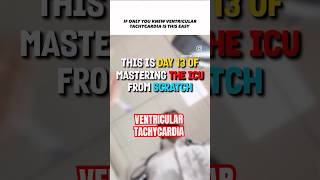 Ventricular tachycardia in ICU