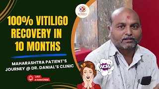 100% Vitiligo Recovery in 10 Months | Maharashtra Patient’s Journey | Dr. Danial’s Clinic