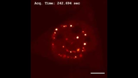 Intracellular patterning of liquid droplets in live cells