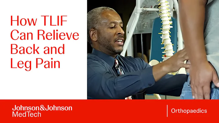 Transforaminal Lumbar Interbody Fusion (TLIF) Explained: From Surgery to Recovery | DePuy Synthes