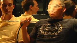 "Got Hookah?" News - Special Report: Mouth to Mouth - Got Herpes? Yes You Can Contract Herpes From A Hookah Pipe