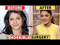 SHOCKING Plastic Surgery of Bollywood Actresses BEFORE &amp; AFTER | Anushka Sharma, Rakhi Sawant