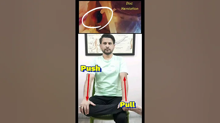 L4-L5-S1 Disc Herniation Exercise..#Scaitica#physiotherapy#shorts