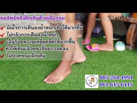 ตอนที่293 วิธีแก้ปัญหาการเดินขาสั้นยาวไม่เท่ากัน