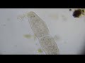 ゾウリムシの細胞分裂 10倍速版