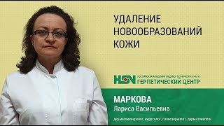 Удаление новообразований кожи