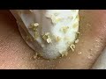 Satisfying Hien Spa Beauty Relaxing Video #02