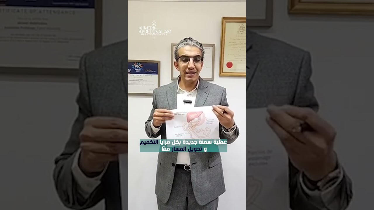 الآن في مصرعملية ال SADI S مع د.أحمد عبد السلام عملية جديدة جمعت مميزات التكميم وتحويل المسار كاملًة