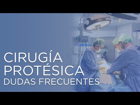 Dudas frecuentes sobre