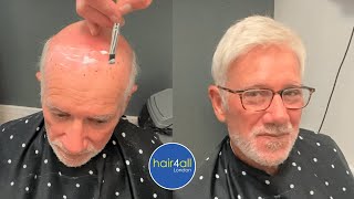Before & After | Hair System | Non-Surgical Hair Replacement System Men/Women | UK/USA/International
