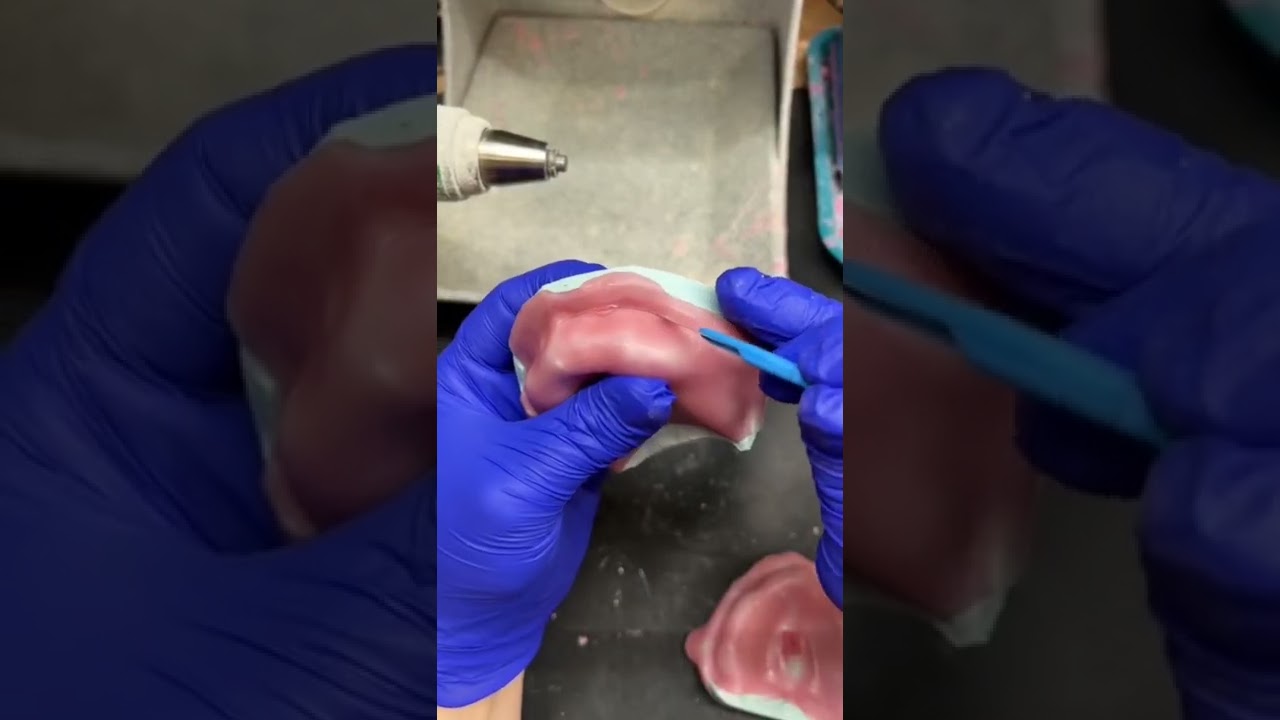 Light cure baseplate 