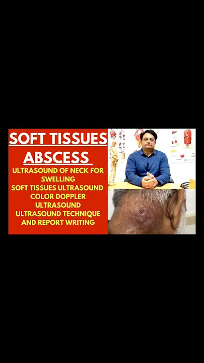 #ultrasound #mskultrasound #swelling #skin #softtissue #radiology #sonologist #video #youtube #usg