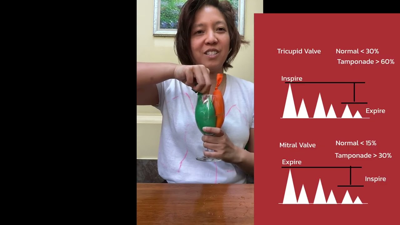 Понимание тампонады