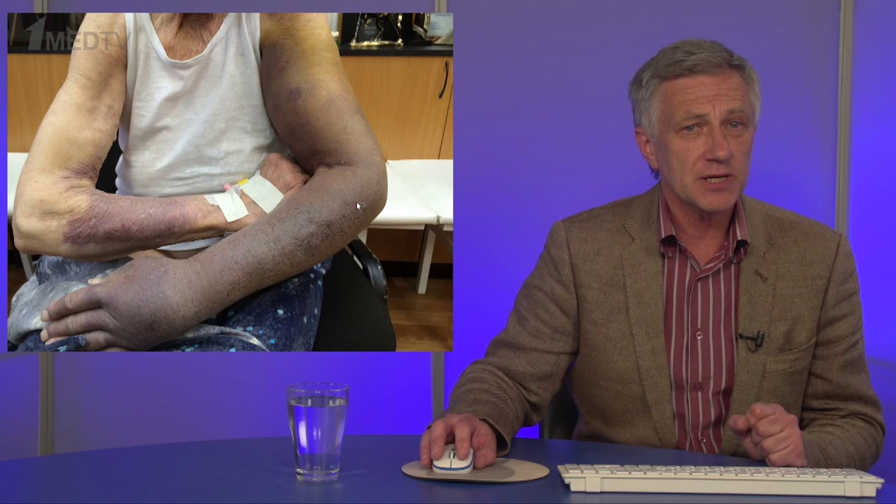 Копенкин С.С. «Применение препарата Целебрекс (Целекоксиб) в периоперационном периоде...»