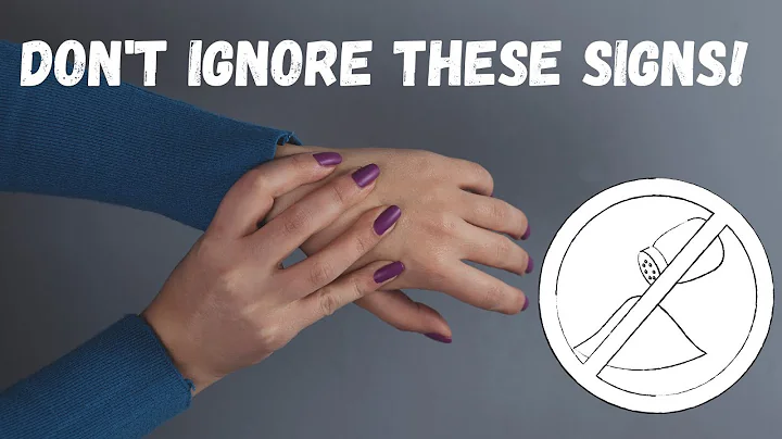 7 Surprising Signs You're Eating Too Much Salt (Don't Ignore!)