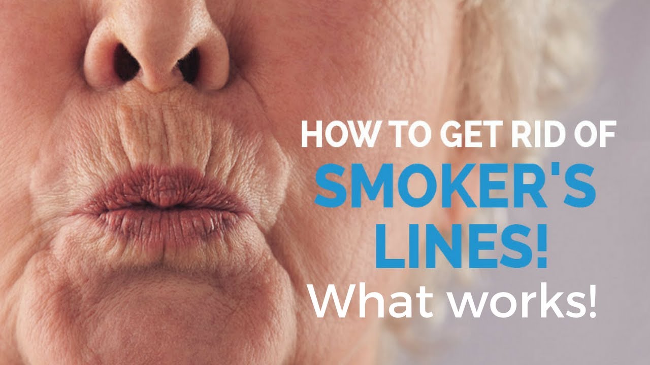 How To Remove Smoker s Lines Update YouTube