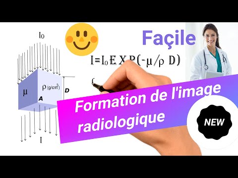 Vidéo: Imagerie Du Tenseur De Diffusion Pour L'évaluation Des Changements Microstructuraux Associés Aux Résultats Du Traitement à Un An Après La Radiofréquence Rhizotomie Dans La Név