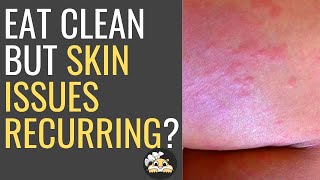 Eat Clean but Still Have Skin Issues? by Hungry Gopher 303 views 1 year ago 5 minutes, 8 seconds